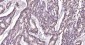 PCNA Mouse mAb, Nuclear Loading Control